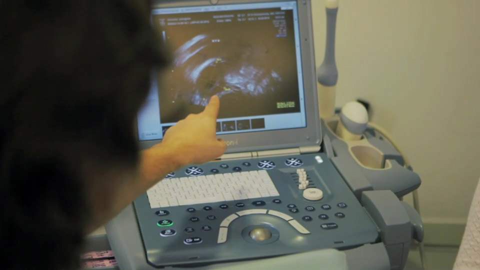 Machine Ultrasound